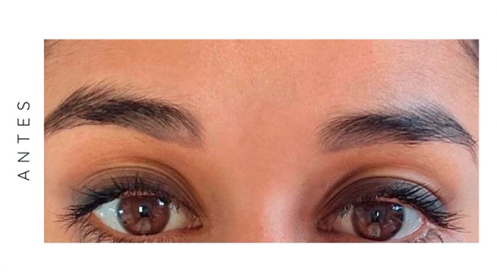 ¡Renueva tu mirada!