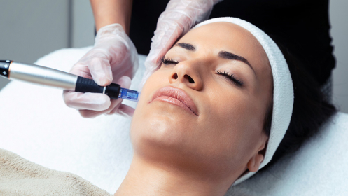 Tratamiento facial Dermapen en Dh Esthetic
