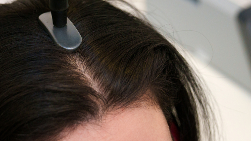 Frena la caída y recupera la vitalidad de tu pelo con Indiba