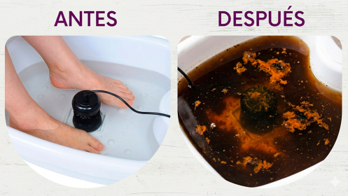 5 Sesiones de Desintoxicación Iónica