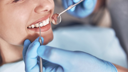 Limpieza dental profesional por solo 15€