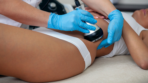 3 sesiones de cavitación + 3 sesiones de presoterapia